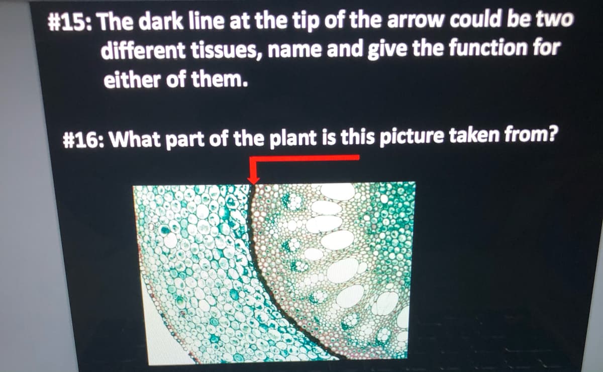 #15: The dark line at the tip of the arrow could be two
different tissues, name and give the function for
either of them.
#16: What part of the plant is this picture taken from?

