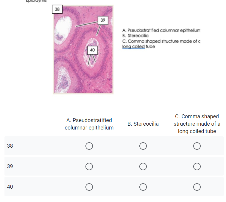 38
39
A. Pseudostratified columnar epithelium
B. Stereocilia
C. Comma shaped structure made of c
long coiled tube
40
C. Comma shaped
structure made of a
A. Pseudostratified
B. Stereocilia
columnar epithelium
long coiled tube
38
39
40
