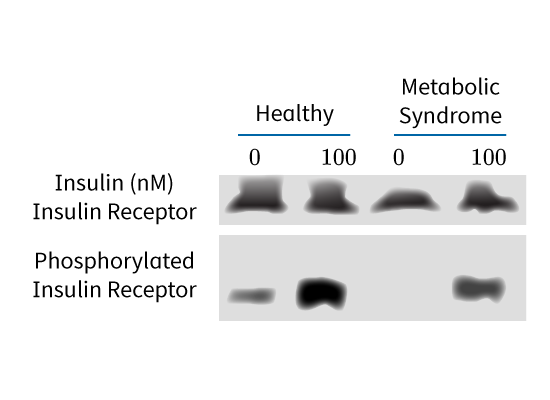Insulin (NM)
Insulin Receptor
Phosphorylated
Insulin Receptor
Healthy
0
Metabolic
Syndrome
100
100 0