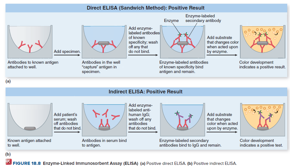 Direct ELISA (Sandwich Method): Positive Result
Enzyme-labeled
secondary antibody
Enzyme
Add enzyme-
labeled antibodies
of known
specificity; wash
off any that
do not bind.
Add substrate
that changes color
when acted upon
by enzyme.
Add specimen.
Antibodies to known antigen
attached to well.
Enzyme-labeled antibodies
of known specificity bind
antigen and remain.
Color development
indicates a positive result.
Antibodies in the well
"capture" antigen in
specimen.
(a)
Indirect ELISA: Positive Result
Add enzyme-
labeled anti-
human IgG;
wash off any
antibodies
that do not bind.
トイア
Add patient's
serum; wash
off antibodies
that do not bind.
Add substrate
that changes
color when acted
upon by enzyme.
Known antigen attached
to well.
Color development
indicates a positive test.
Antibodies in serum bind
Enzyme-labeled secondary
antibodies bind to IgG and remain.
to antigen.
(b)
FIGURE 18.8 Enzyme-Linked Immunosorbent Assay (ELISA) (a) Positive direct ELISA. (b) Positive indirect ELISA.
