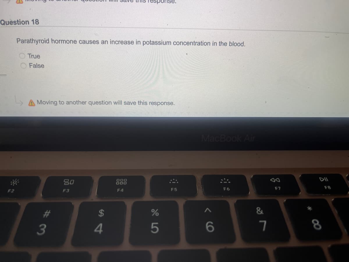 Question 18
Parathyroid hormone causes an increase in potassium concentration in the blood.
True
False
A Moving to another question will save this response.
#3
80
F3
$
response.
4
000
000
F4
%
45
F5
MacBook Air
6
F6
&
7
o
F7
8
F8