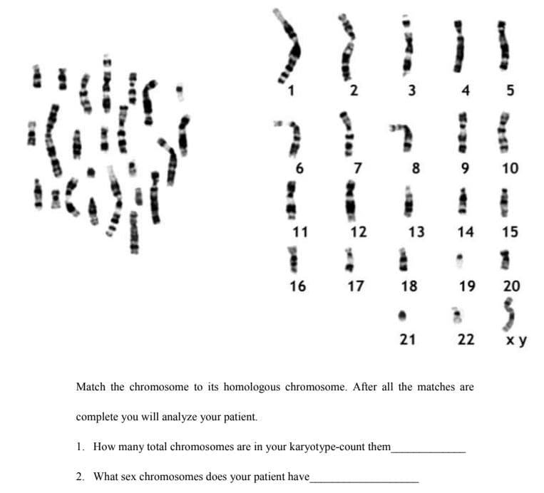 4 5
6
7
8
9
10
11
12 13
14
15
16
17
18
19
20
21
22
ху
Match the chromosome to its homologous chromosome. After all the matches are
complete you will analyze your patient.
1. How many total chromosomes are in your karyotype-count them
2. What sex chromosomes does your patient have
2)
