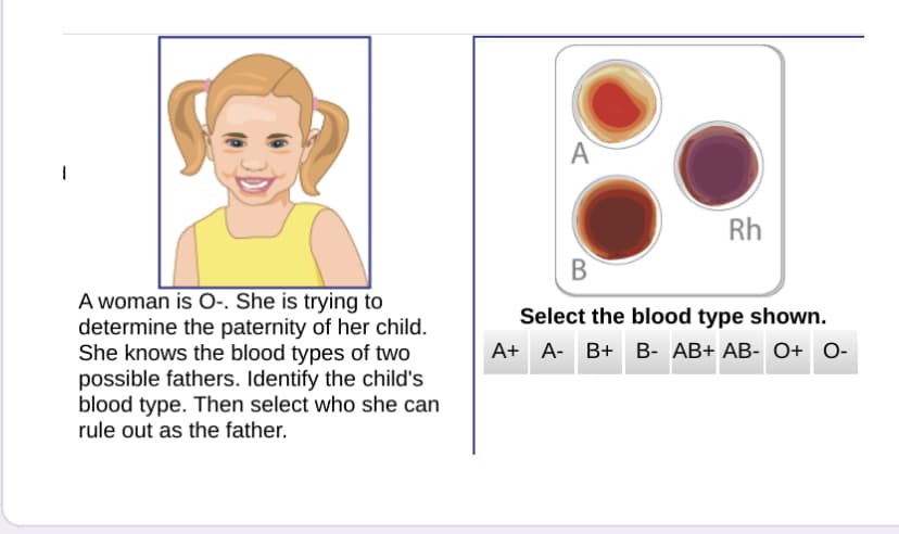 A
Rh
В
A woman is O-. She is trying to
determine the paternity of her child.
She knows the blood types of two
possible fathers. Identify the child's
blood type. Then select who she can
rule out as the father.
Select the blood type shown.
A+ A- B+ B- AB+ AB- O+ O-

