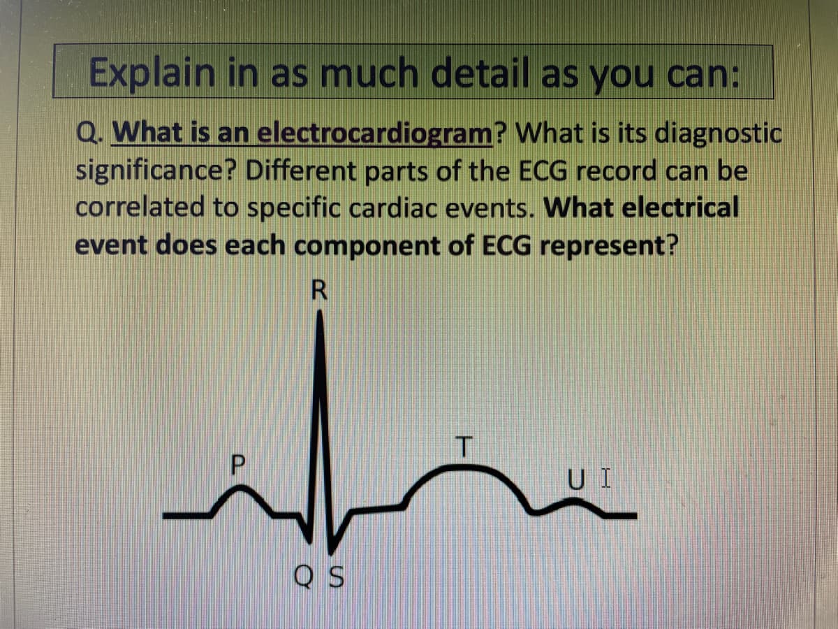 Explain in as much detail as you can:
Q. What is an electrocardiogram? What is its diagnostic
significance? Different parts of the ECG record can be
correlated to specific cardiac events. What electrical
event does each component of ECG represent?
R
U I
Q S
P.
