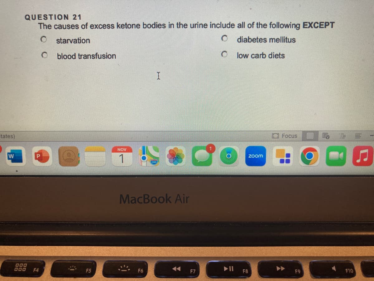 tates)
W
QUESTION 21
The causes of excess ketone bodies in the urine include all of the following EXCEPT
C
starvation
diabetes mellitus
O blood transfusion
low carb diets
000
P
F4
F5
NOV
1
I
MacBook Air
F6
F7
F8
zoom
Focus
F9
F10