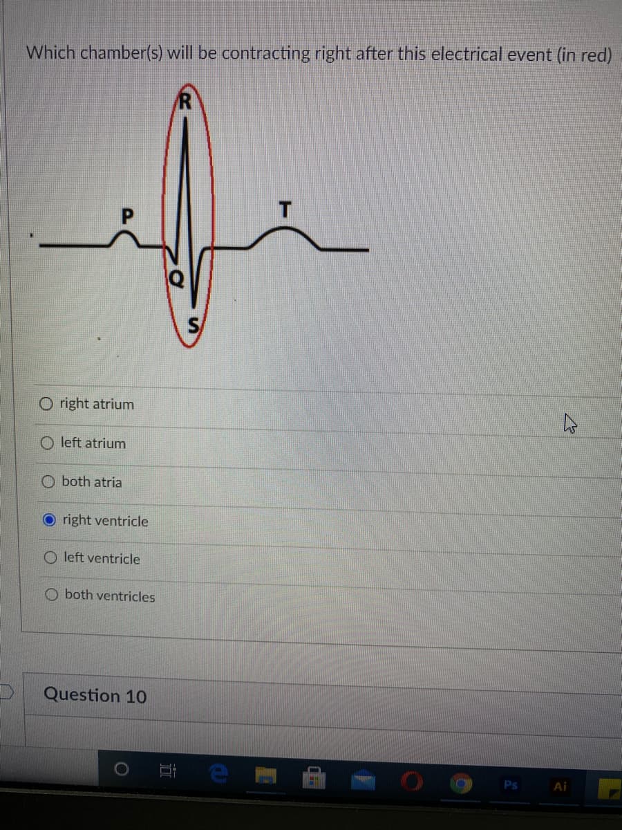 Which chamber(s) will be contracting right after this electrical event (in red)
O right atrium
left atrium
O both atria
O right ventricle
O left ventricle
O both ventricles
Question 10
Ps
