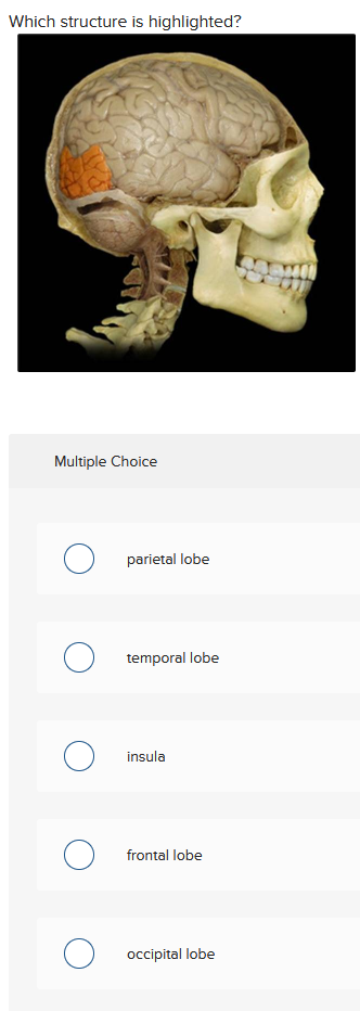 Which structure is highlighted?
Multiple Choice
O parietal lobe
O temporal lobe
O insula
O frontal lobe
O occipital lobe