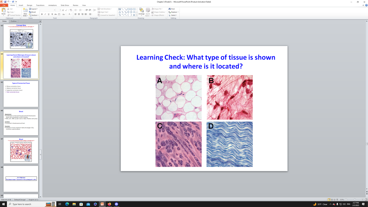 P
File
Paste
Slides
63
64
65
66
67
68
69
Home Insert Design Transitions Animations
Cut
Copy
Format Painter
Clipboard
Outline
New
Slide
Compact Bone
** You do noted to knowindwdd anchures until Chapter 5 **
• Fibrous connective tissue
• Adipose connective tissue
Learning Check: What type of tissue is shown
and where is it located?
• Supportive connective tissue
. Fluid connective tissue
Types of Connective Tissue
Slides
Blood
Layout
Reset
Section
Location:
contained in blood vessels and heart
Slide 64 of 86
+
Appearance
Combination of red (erythrocytes) and white (leukocytes)
blood cells and platelets carried in plasma.
▪ RBC: pink, WBC: purple nudei or lobes, Platelets: dark pieces
Function:
Transport of many important molecules (oxygen, CO₂),
hormones, waste products.
Blood
d to know iná váà à call types until Chapter 19**
3.4: Nervous
Reviewonown/laband in the subsequent units
"Default Design"
Type here to search
English (U.S.)
Slide Show
Font
Á A
B I U Sabe AV Aa A -
Aal
6:
Review
View
E E E-
| |-
A Text Direction -
Align Text
Convert to SmartArt
Paragraph
Po
A\\00
ALLG
4\^{ }☆
LO
Arrange Quick
Styles
Drawing
Chapter 3 (Final) (1) - Microsoft PowerPoint (Product Activation Failed)
Shape Fill
Shape Outline
Shape Effects
Learning Check: What type of tissue is shown
and where is it located?
B
A
Find
Replace ▾
Select -
Editing
C
Golars 29
3809DOTES
OD
D
35°F Clear
121%
I
4) ENG
0
2:27 PM
2/3/2023
x
?
+*