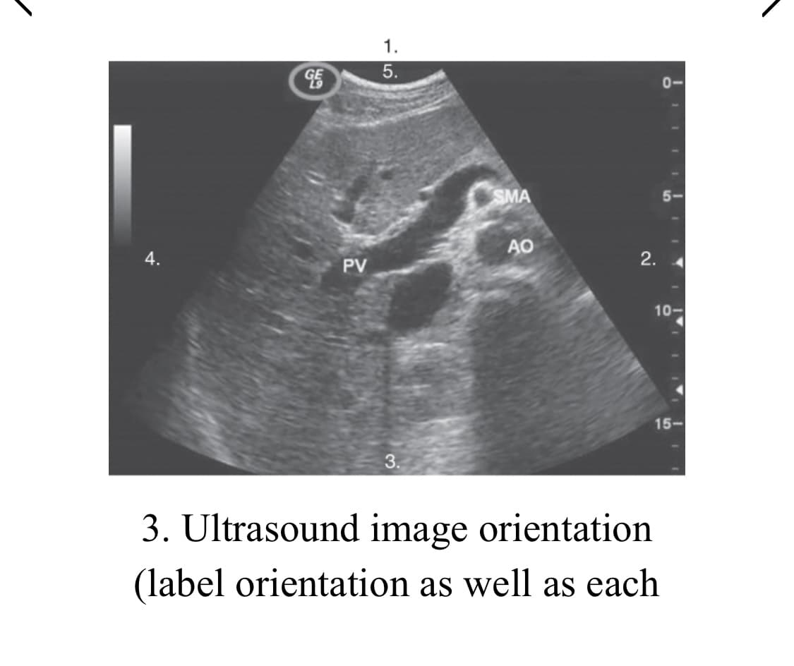 1.
5.
0-
SMA
4.
AO
PV
2.
10-
15-
3.
3. Ultrasound image orientation
(label orientation as well as each
