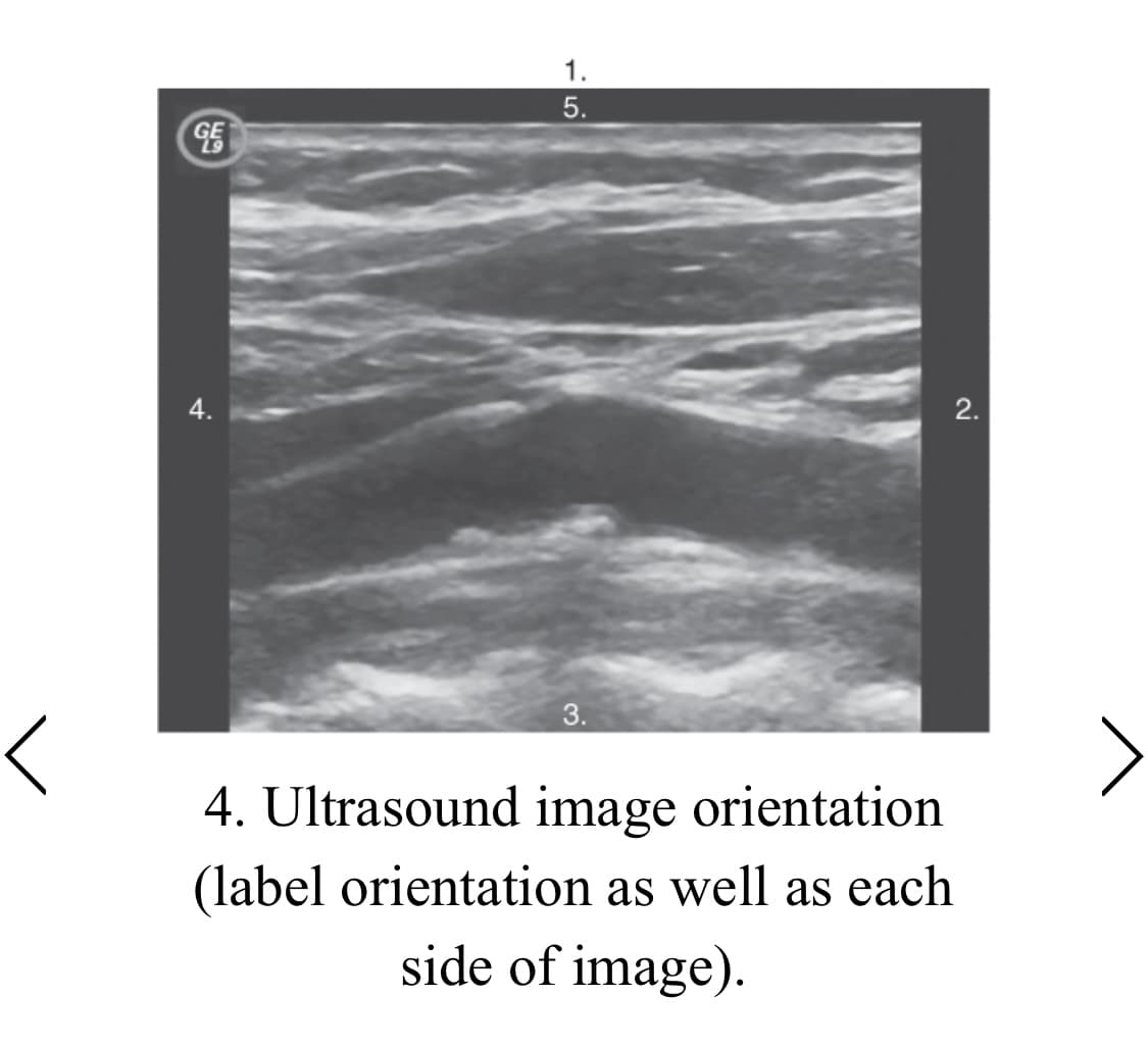 1.
4.
2.
3.
4. Ultrasound image orientation
(label orientation as well as each
side of image).
5.
