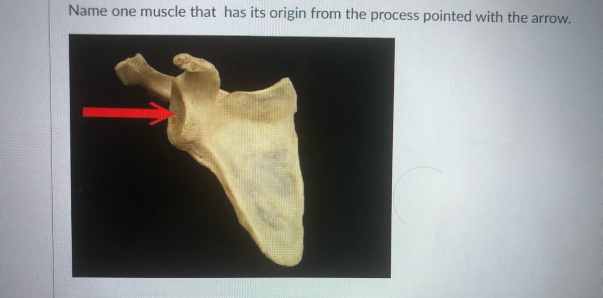 Name one muscle that has its origin from the process pointed with the arrow.
