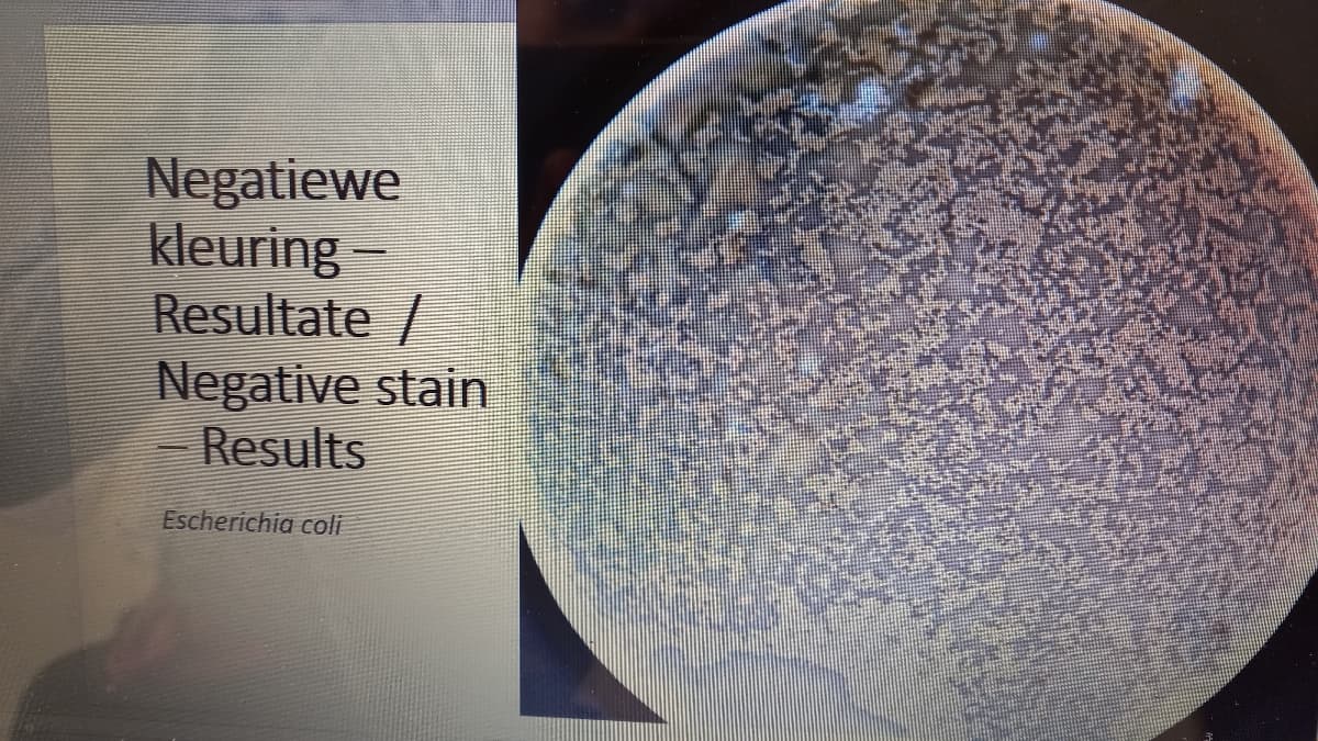 Negatiewe
kleuring -
Resultate /
Negative stain
- Results
Escherichia coli
