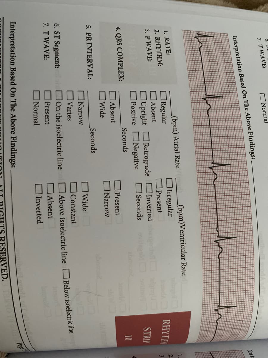 6.
7. T WAVE:
Interpretation Based On The Above Findings:
1. RATE:
2. RHYTHM:
3. P WAVE:
91212
4. QRS COMPLEX:
Normal
5. PR INTERVAL:
(bpm) Atrial Rate
Regular
Absent
Upright Retrograde
Positive
Negative
Absent
Wide
h
Seconds
Seconds
Narrow
Varies
6. ST Segment: loh On the isoelectric line
7. T WAVE:
Present
Normal
Interpretation Based On The Above Findings:
(bpm) Ventricular Rate
Irregular
Present
h
Inverted obargou
Seconds
Present
Narrow
Wide
Constant
Above isoelectric line
Absent
Inverted
abiw
RHYTHM
STRIP
10
JAVANTA
Below isoelectric line
butt svodd off 201
RVED.
Int
1.
2.
290 70 Page
3-