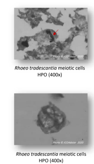 Photo JCOAdajar 2020
Rhoeo tradescantia meiotic cells
НРО (400х)
Photo © JCOAdajar 2020
Rhoeo tradescantia meiotic cells
НРО (400х)
