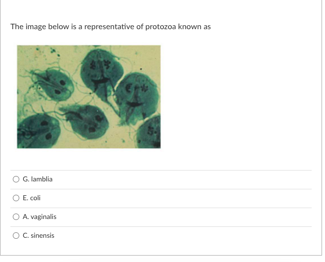 The image below is a representative of protozoa known as
G. lamblia
O E. coli
A. vaginalis
C. sinensis

