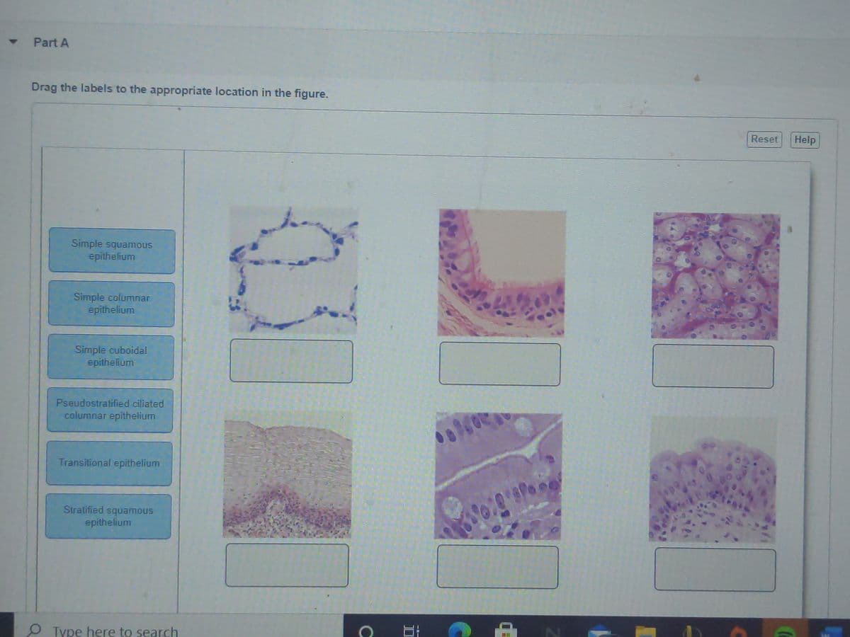 Part A
Drag the labels to the appropriate location in the figure.
Reset
Help
Simple squamous
epithelium
Simple columnar
epithelium
Simple cuboidal
epithelium
Pseudostratified ciliated
columnar epithelium
Transitional epithelium
Stratified squamous
epithelium
O Typę here to search
