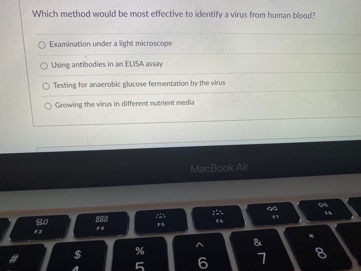 Which method would be most effective to identify a virus from human blood?
O Examination under a light microscope
O Using antibodies in an ELISA assay
Testing for anaerobic glucose fermentation by the virus
Growing the virus in different nutrient media
MacBook Air
吕0
000
000
F8
F7
F5
F6
F3
F4
&
$
8
