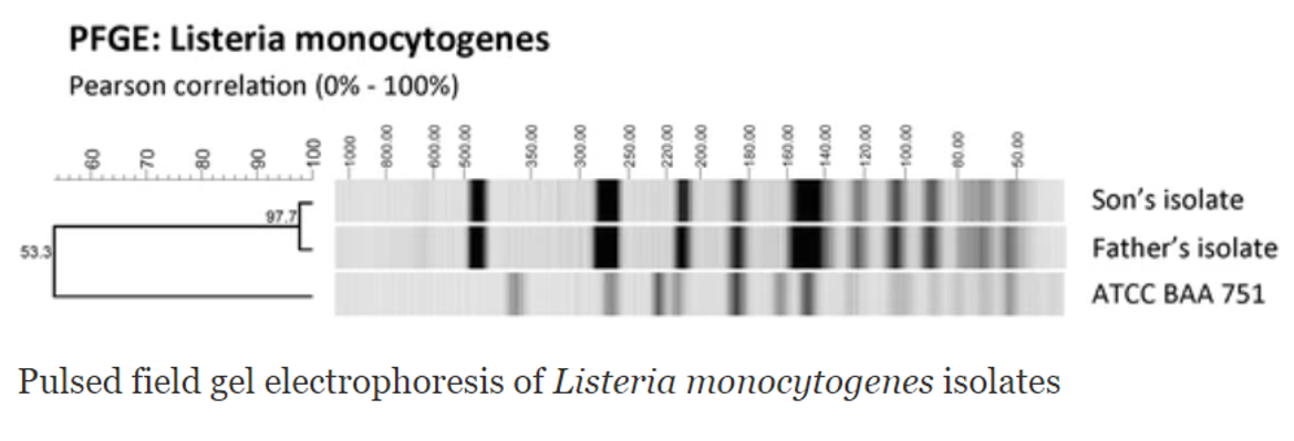 PFGE: Listeria monocytogenes
Pearson correlation (0% - 100%)
Son's isolate
97.7
53.3
Father's isolate
АТСС ВАА 751
Pulsed field gel electrophoresis of Listeria monocytogenes isolates
00 09
00 00
00 001
120.00
00'0-
00 094
00'08
00 002
00 ozz
250.00
00'00e
00'ose
00 00s
00 009
000
001-
