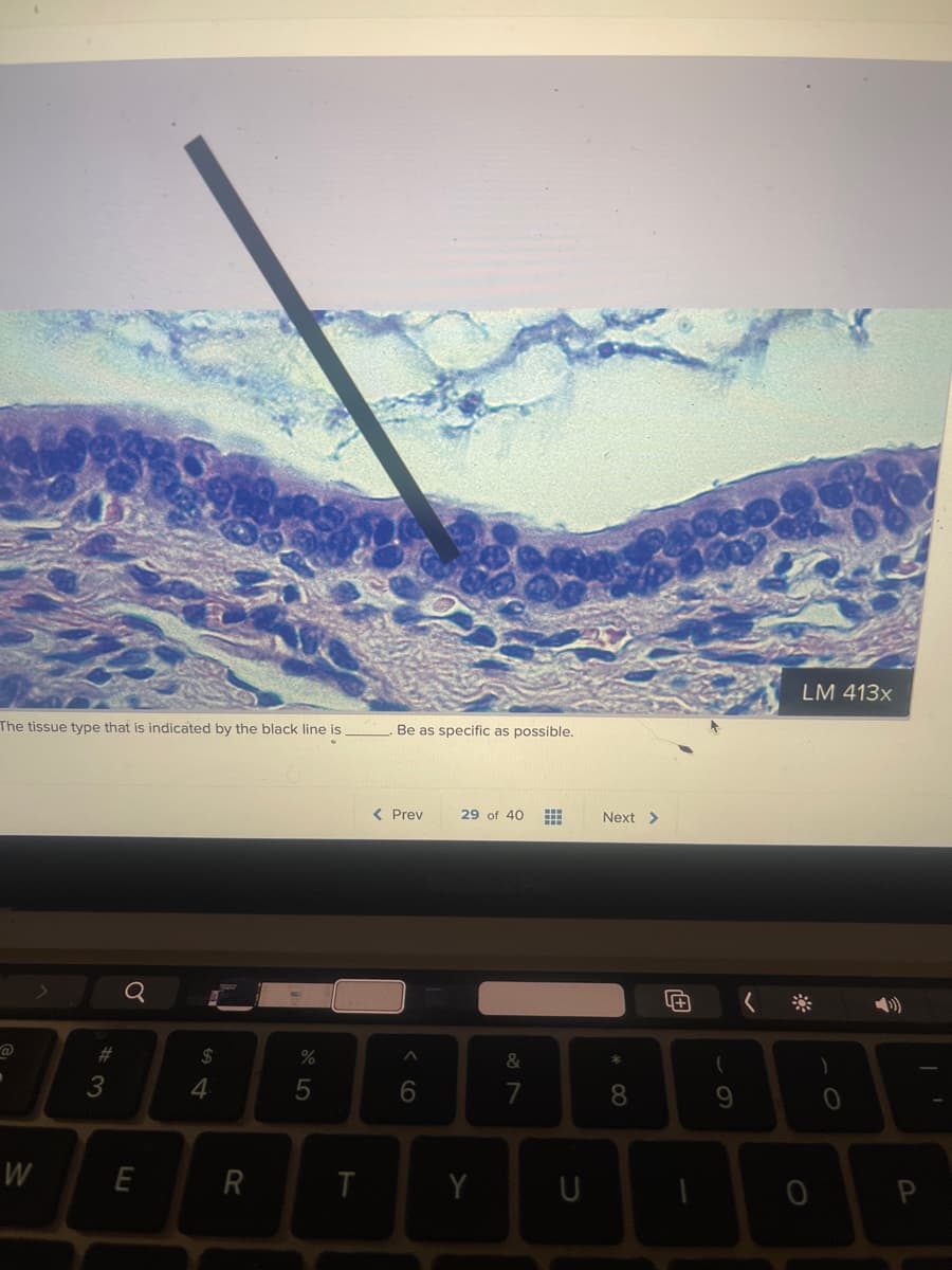 The tissue type that is indicated by the black line is
.
W
#3
Q
E
$
4
R
%
5
T
Be as specific as possible.
< Prev
6
29 of 40 #
Y
&
U
Next >
8
4+
1
61
LM 413x
P