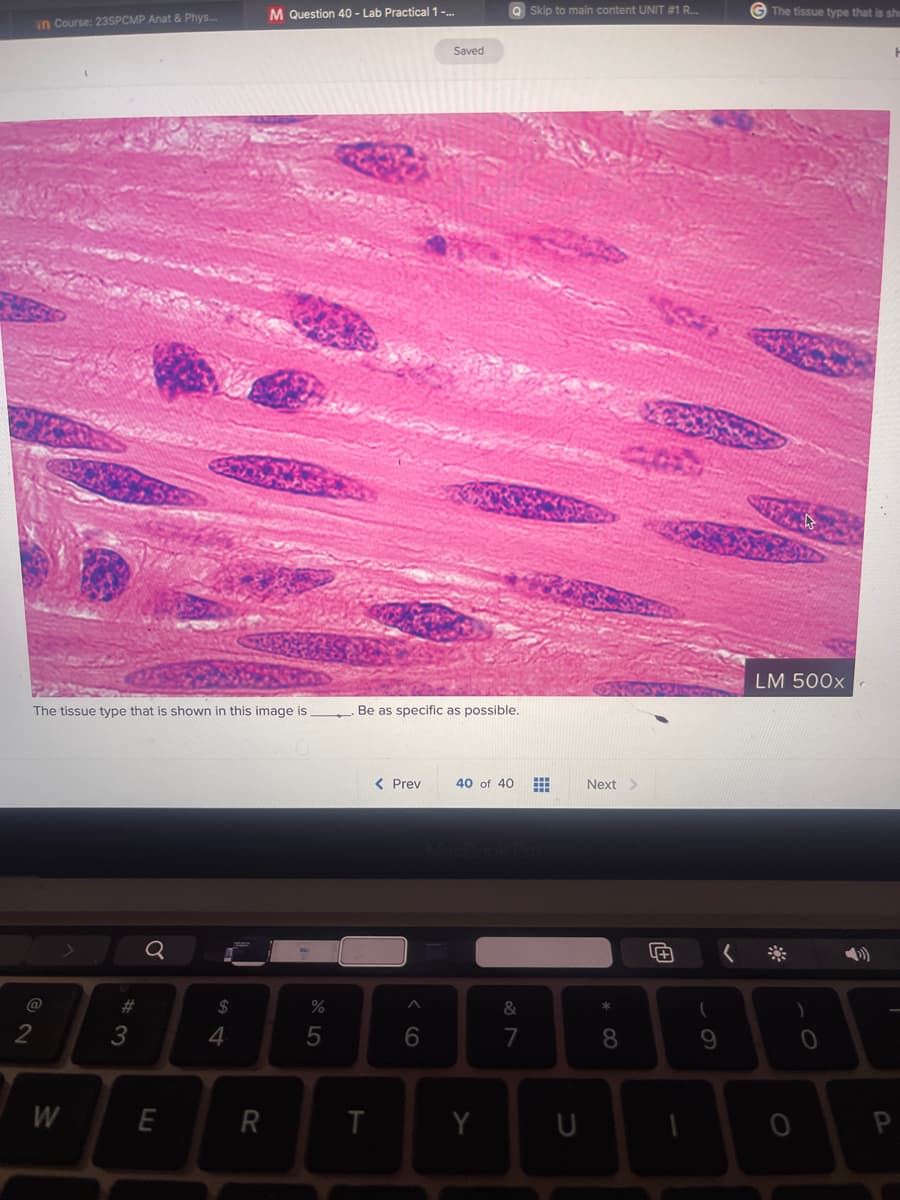 in Course: 23SPCMP Anat & Phys...
The tissue type that is shown in this image is
@
2
W
3
Q
E
$
4
M Question 40 - Lab Practical 1 -...
R
%
5
T
Be as specific as possible.
< Prev
^
Saved
6
QSkip to main content UNIT #1 R...
40 of 40
Y
&
7
U
Next >
*
8
+
(
9
GThe tissue type that is she
LM 500x
H
P