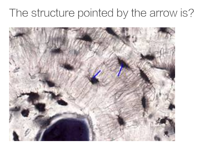 The structure pointed by the arrow is?
