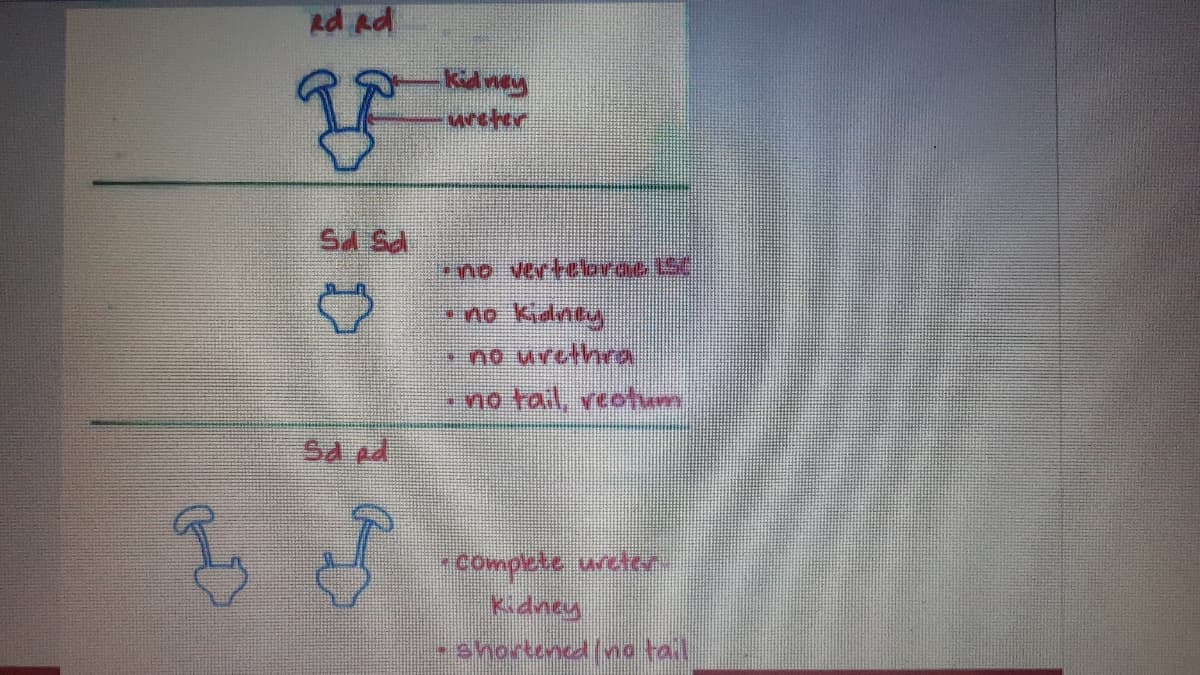 ad ad
भु
Sl Sa
Saed
58
Kidney
-wrefer
"no Verbelorac ISC.
·no Kidnily
* no urethra
- no tail,
veotum
-complete ureter
Kidney
- shortenelina tail