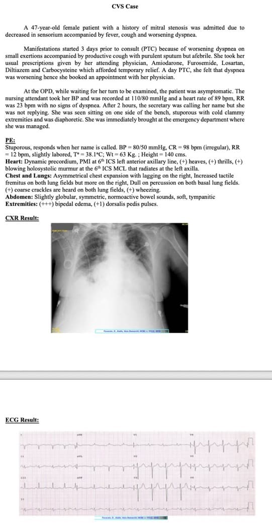 A 47-year-old female patient with a history of mitral stenosis was admitted due to
decreased in sensorium accompanied by fever, cough and worsening dyspnea.
Manifestations started 3 days prior to consult (PTC) because of worsening dyspnea on
small exertions accompanied by productive cough with purulent sputum but afebrile. She took her
usual prescriptions given by her attending physician, Amiodarone, Furosemide, Losartan,
Diltiazem and Carbocysteine which afforded temporary relief. A day PTC, she felt that dyspnea
was worsening hence she booked an appointment with her physician.
CVS Case
At the OPD, while waiting for her turn to be examined, the patient was asymptomatic. The
nursing attendant took her BP and was recorded at 110/80 mmHg and a heart rate of 89 bpm, RR
was 23 bpm with no signs of dyspnea. After 2 hours, the secretary was calling her name but she
was not replying. She was seen sitting on one side of the bench, stuporous with cold clammy
extremities and was diaphoretic. She was immediately brought at the emergency department where
she was managed.
PE:
Stuporous, responds when her name is called. BP = 80/50 mmHg, CR = 98 bpm (irregular), RR
= 12 bpm, slightly labored, T° = 38.1°C; Wt = 63 Kg. ; Height = 140 cms.
Heart: Dynamic precordium, PMI at 6th ICS left anterior axillary line, (+) heaves, (+) thrills, (+)
blowing holosystolic murmur at the 6th ICS MCL that radiates at the left axilla.
Chest and Lungs: Asymmetrical chest expansion with lagging on the right, Increased tactile
fremitus on both lung fields but more on the right, Dull on percussion on both basal lung fields.
(+) coarse crackles are heard on both lung fields, (+) wheezing.
Abdomen: Slightly globular, symmetric, normoactive bowel sounds, soft, tympanitic
Extremities: (+++) bipedal edema, (+1) dorsalis pedis pulses.
CXR Result:
ECG Result:
ave
FD. A NOR
T m n
42
va
www
Hrv
ppppp
grap
v4