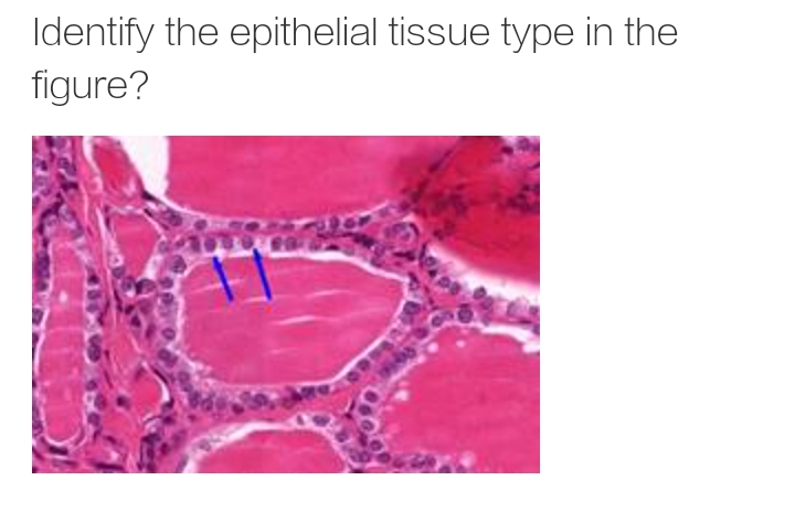 Identify the epithelial tissue type in the
figure?
