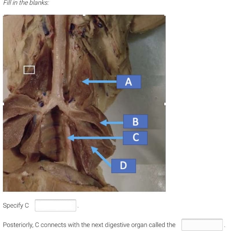 Fill in the blanks:
A
B
C
D
Specify C
Posteriorly, C connects with the next digestive organ called the
