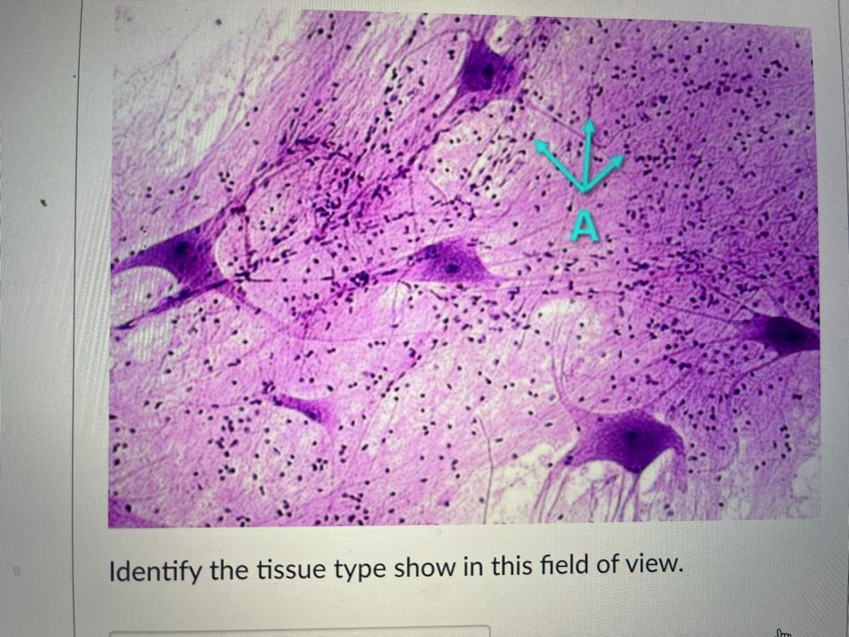 Identify the tissue type show in this field of view.
