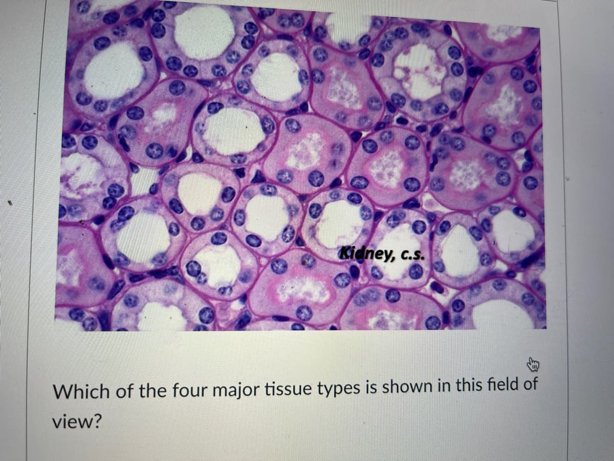 Kidney, c.s.
Which of the four major tissue types is shown in this field of
view?
