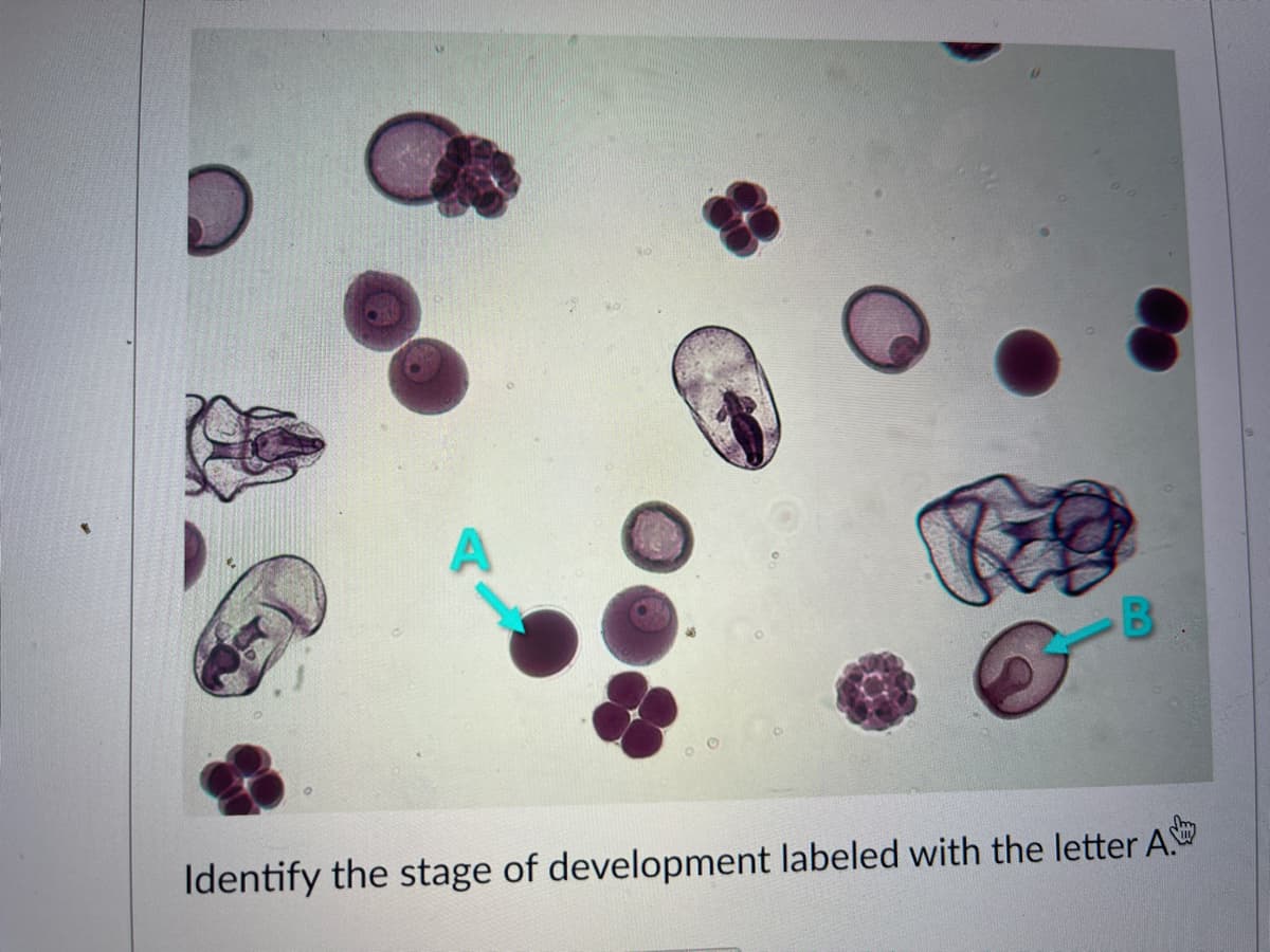 Identify the stage of development labeled with the letter A
