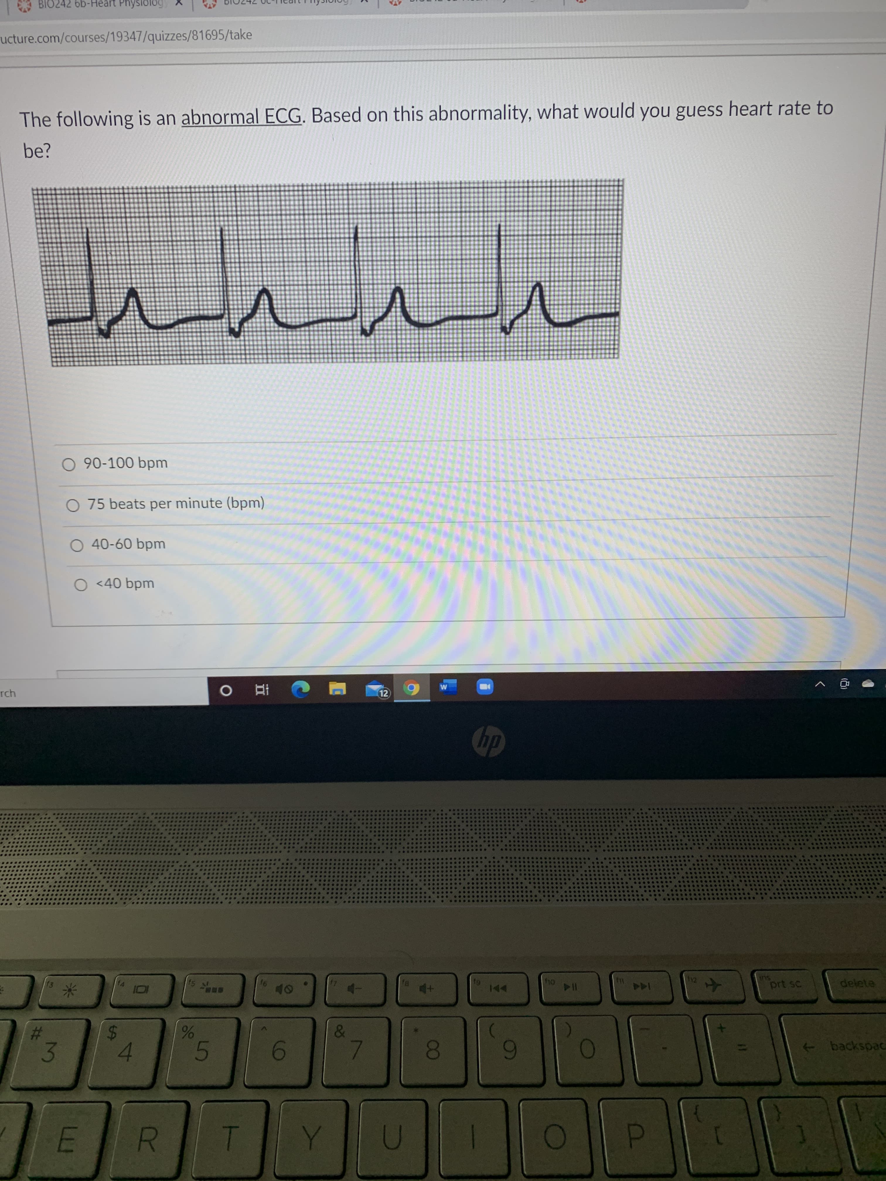 The following is an abnormal ECG. Based on this abnormality, what would you guess heart rate to
be?
