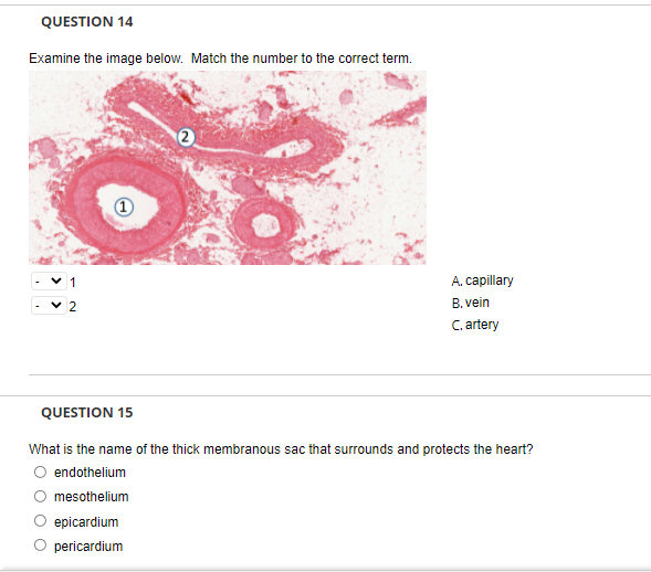 QUESTION 14
Examine the image below. Match the number to the correct term.
v 1
A. capillary
- v 2
B. vein
C. artery
QUESTION 15
What is the name of the thick membranous sac that surrounds and protects the heart?
O endothelium
mesothelium
epicardium
pericardium
