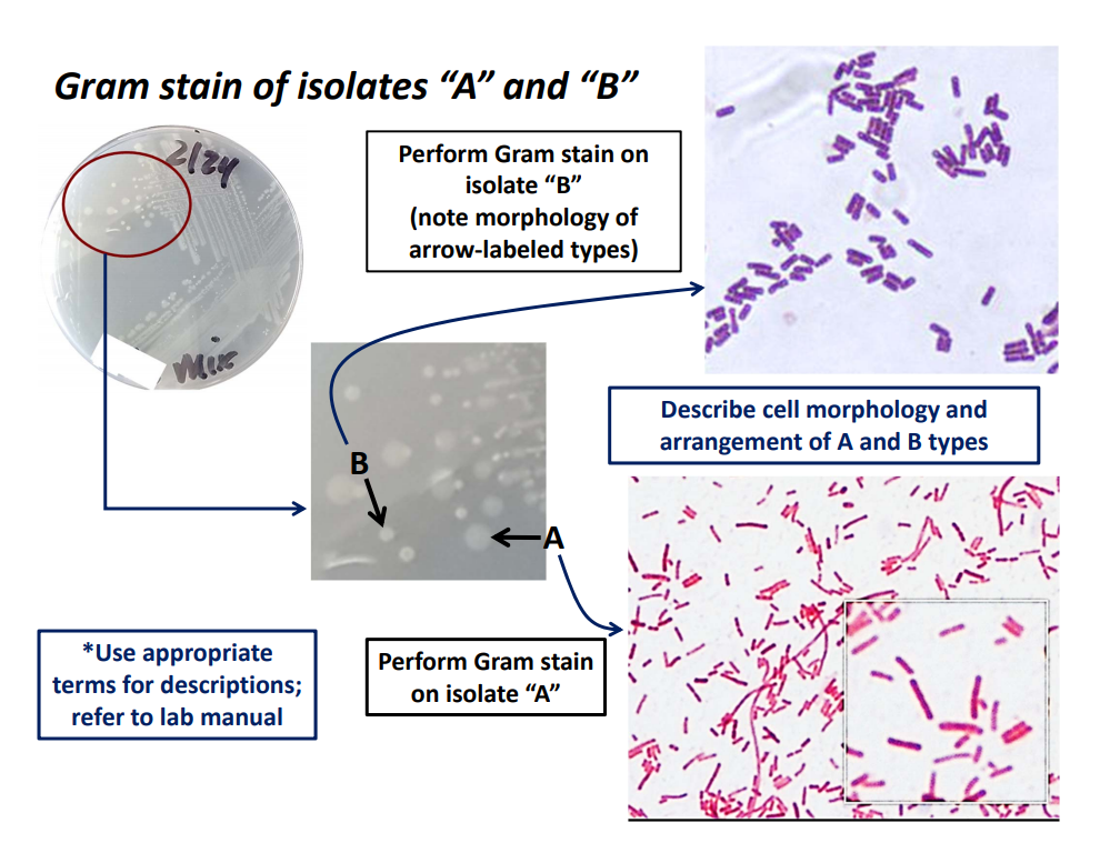 Gram stain of isolates "A" and "B"
Perform Gram stain on
isolate "B"
(note morphology of
arrow-labeled types)
Mee
Describe cell morphology and
arrangement of A and B types
В
*Use appropriate
terms for descriptions;
Perform Gram stain
on isolate "A"
refer to lab manual
