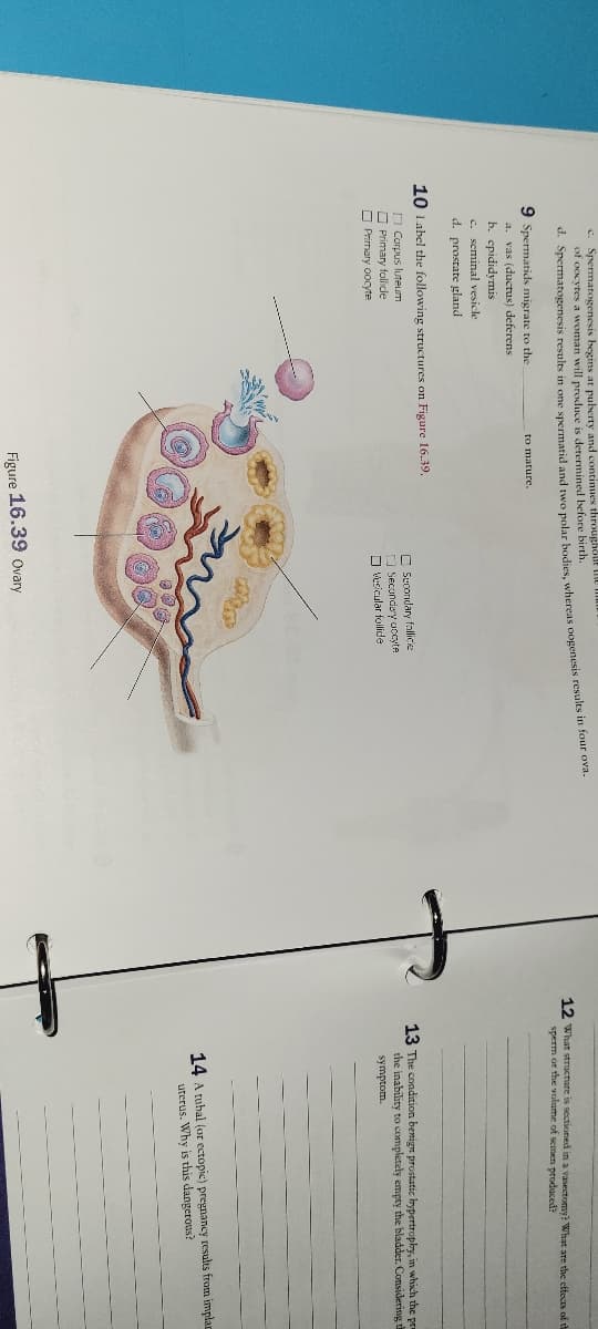 c. Spermatogenesis begins at puberty and continues throughout the
of oocytes a woman will produce is determined before birth.
d. Spermatogenesis results in one spermatid and two polar bodies, whereas oogenesis results in four ova.
9 Spermatids migrate to the
a. vas (ductus) deferens
b. epididymis
c. seminal vesicle
d. prostate gland
to mature.
10 Label the following structures on Figure 16.39.
Corpus luteum
Primary follicle
Primary oocyte
Secondary follicie
Secondary accyte
Vesicular follide
Figure 16.39 Ovary
12 What structure is sectioned in a vasectomy? What are the effects of th
sperm or the volume of semen produced?
13 The condition benign prostatic hypertrophy, in which the pra
the inability to completely empty the bladder. Considering t
symptom.
14 A tubal (or ectopic) pregnancy results from implan
uterus. Why is this dangerous?