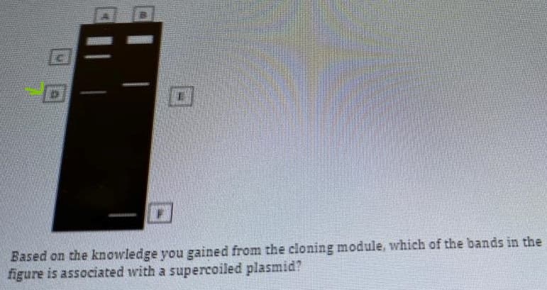 Based on the knowledge you gained from the cloning module, which of the bands in the
figure is associated with a supercoiled plasmid