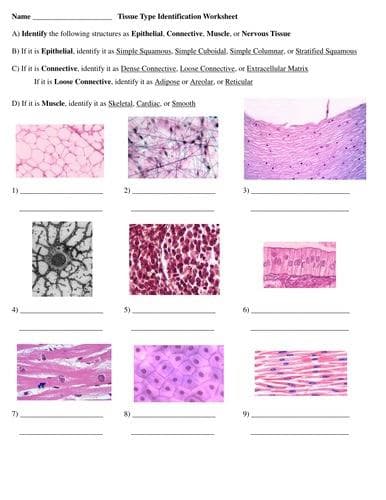 Name
Tissue Type Identification Worksheet
A) Identify the following structures as Epithelial, Connective, Muscle, or Nervous Tissue
B) If it is Epithelial, identify it as Simple Squamous. Simple Cuboidal. Simple Columnar, or Stratified Squamoses
C) If it is connective, identify it as Dense Connective. Loose Connective, or Extracellular Matrix
If it is Loose Connective, identify it as Adipose or Arcolar, or Reticular
D) If it is Muscle, identify it as Skeletal. Cardiac. or Smooth