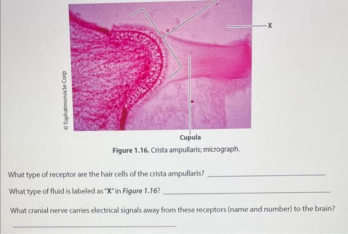 Tophatmonocle Corp
Cupula
Figure 1.16. Crista ampullaris; micrograph.
-X
What type of receptor are the hair cells of the crista ampullaris?
What type of fluid is labeled as "X" in Figure 1.16?
What cranial nerve carries electrical signals away from these receptors (name and number) to the brain?