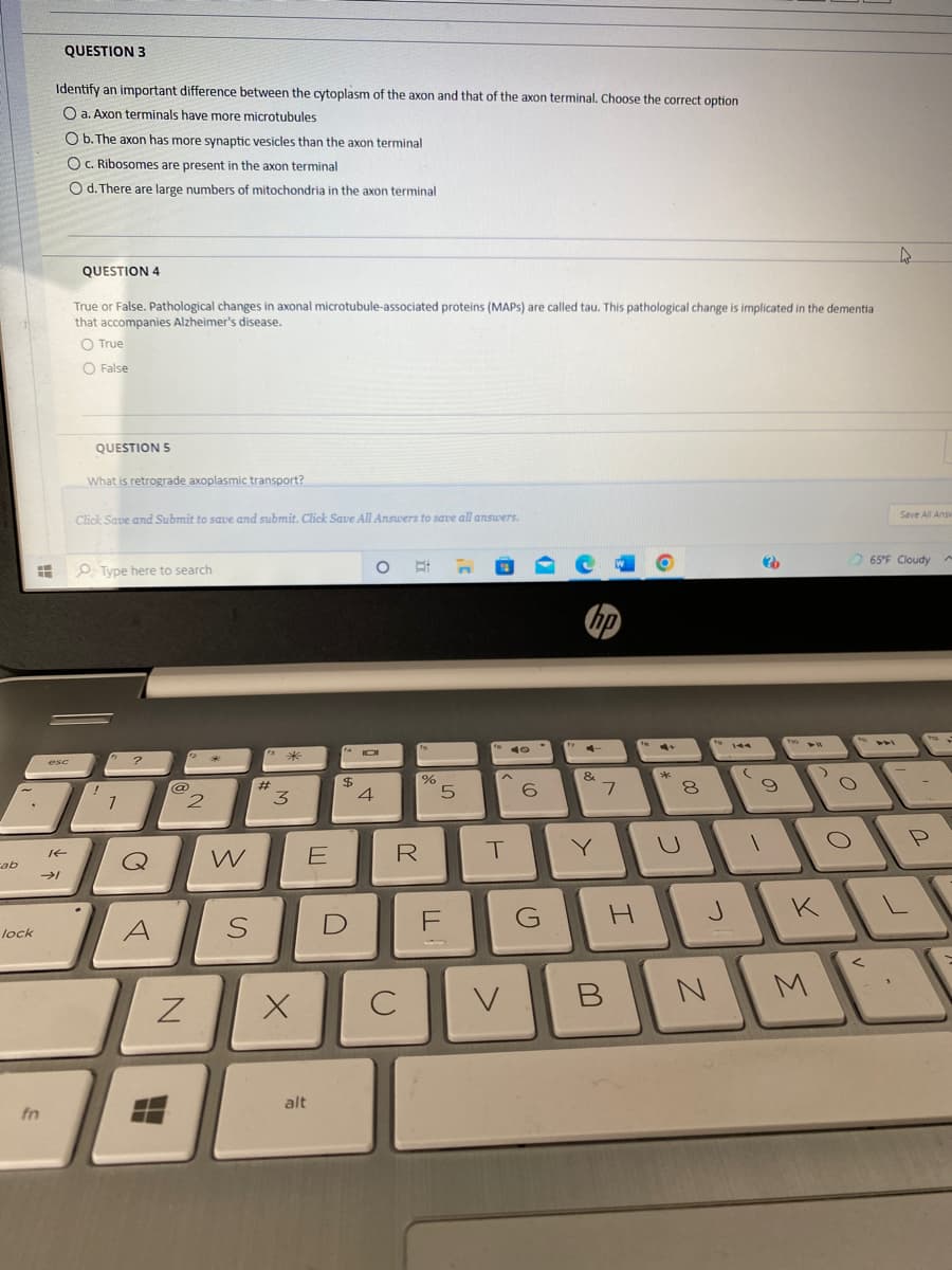 cab
#
.
lock
fn
QUESTION 3
Identify an important difference between the cytoplasm of the axon and that of the axon terminal. Choose the correct option
O a. Axon terminals have more microtubules
KE
→1
O b. The axon has more synaptic vesicles than the axon terminal
O c. Ribosomes are present in the axon terminal
O d. There are large numbers of mitochondria in the axon terminal
esc
QUESTION 4
True or False. Pathological changes in axonal microtubule-associated proteins (MAPS) are called tau. This pathological change is implicated in the dementia
that accompanies Alzheimer's disease.
O True
O False
QUESTION 5
What is retrograde axoplasmic transport?
Click Save and Submit to save and submit. Click Save All Answers to save all answers.
Type here to search
!
7
?
Q
A
@
Z
2
W
S
#
*
3
X
E
alt
4
$
D
O
IDI
4
R
()
C
%
5
LL
F
n
T
V
6
G
hp
4
&
7
B
H
00
8
to 144
J
N
(
?
9
Two
>
K
M
O
O
<
4
1
Save All Ansv
65°F Cloudy A
2
H
ha