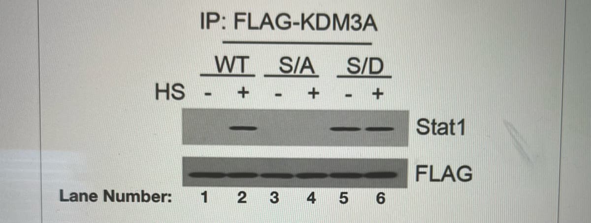 IP: FLAG-KDM3A
WT
HS
SIA
S/D
Stat1
FLAG
Lane Number:
2
4
5 6
