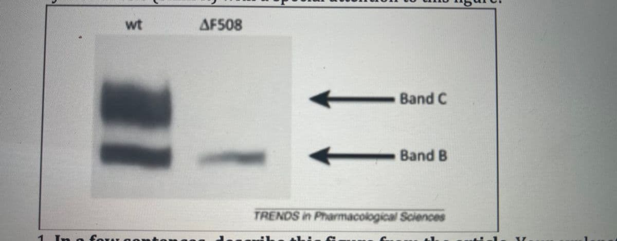 wt
AF508
Band C
Band B
TRENDS in Pharmacological Sciences
n fow
he th:-

