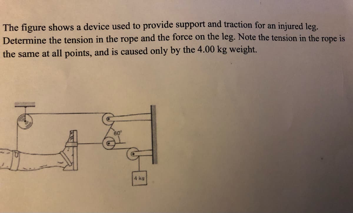 The figure shows a device used to provide support and traction for an injured leg.
Determine the tension in the rope and the force on the leg. Note the tension in the rope is
the same at all points, and is caused only by the 4.00 kg weight.
60°
4 kg