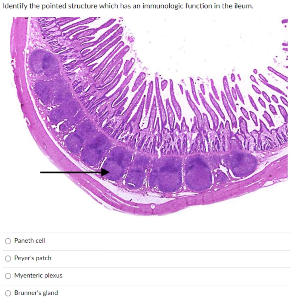 Identify the pointed structure which has an immunologic function in the ileum.
Paneth cell
Peyer's patch
Myenteric plexus
Brunner's gland