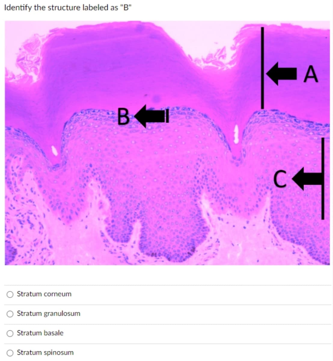 Identify the structure labeled as "B"
Stratum corneum
Stratum granulosum
Stratum basale
Stratum spinosum
B-
C
A