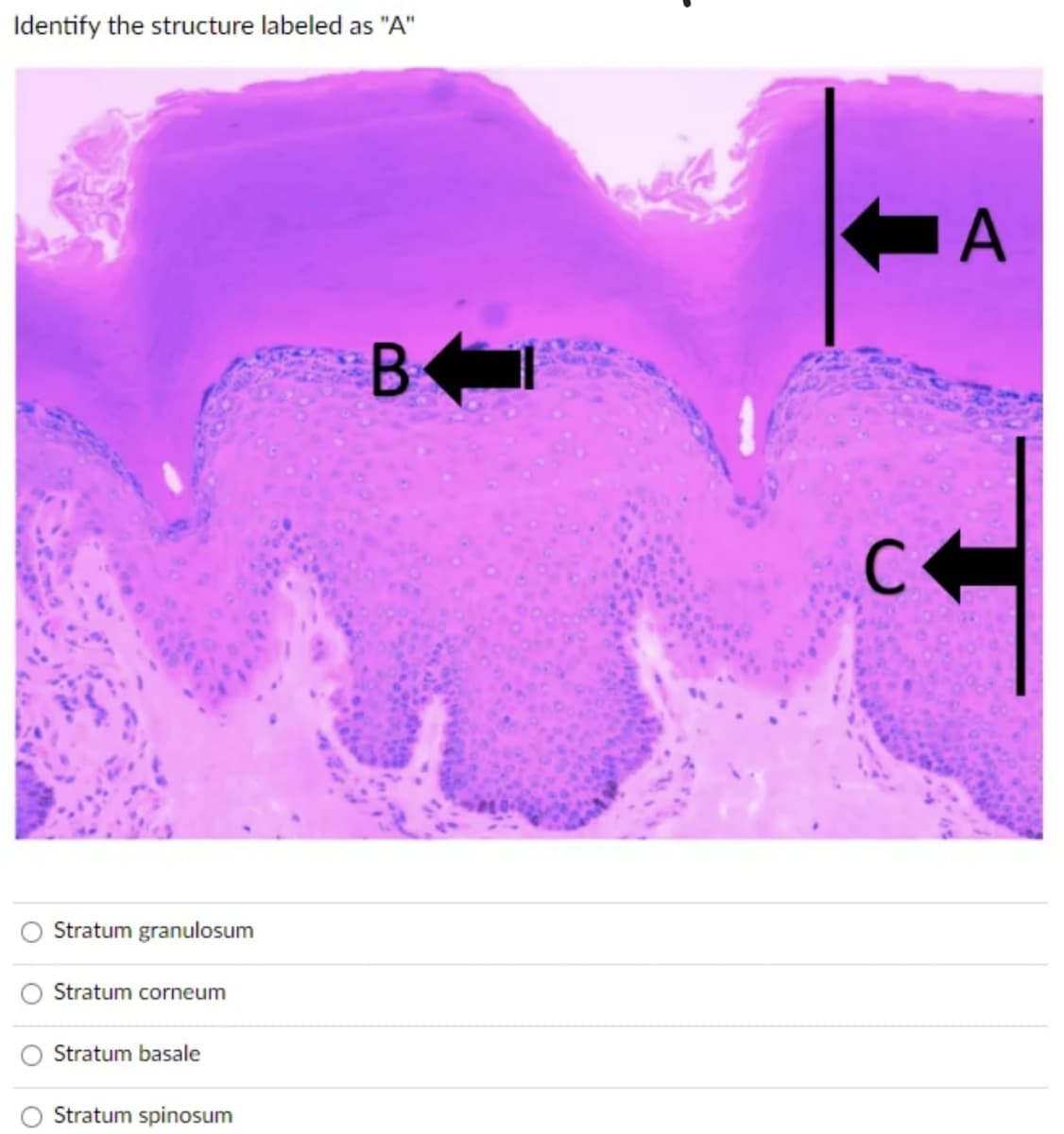Identify the structure labeled as "A"
Stratum granulosum
Stratum corneum
Stratum basale
Stratum spinosum
B
C
A