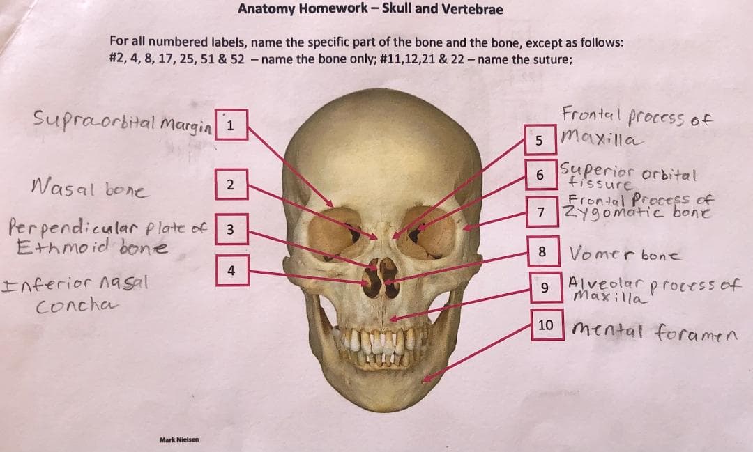 Anatomy Homework-Skull and Vertebrae
For all numbered labels, name the specific part of the bone and the bone, except as follows:
# 2, 4, 8, 17, 25, 51 & 52 -name the bone only; #11,12,21 & 22 - name the suture;
Supraorbital margin
Frontal process of
5 maxilla
1
Superior orbital
fissure
Frontal Process of
7 Zygomatic bone
6.
Wasal bone
2
Per pendicular p late of
Ethmo id bone
3
8
Vomer bone
4
Inferior nasal
Concha
Alveolar processof
Maxilla
10 mental foramen
Mark Nielsen
