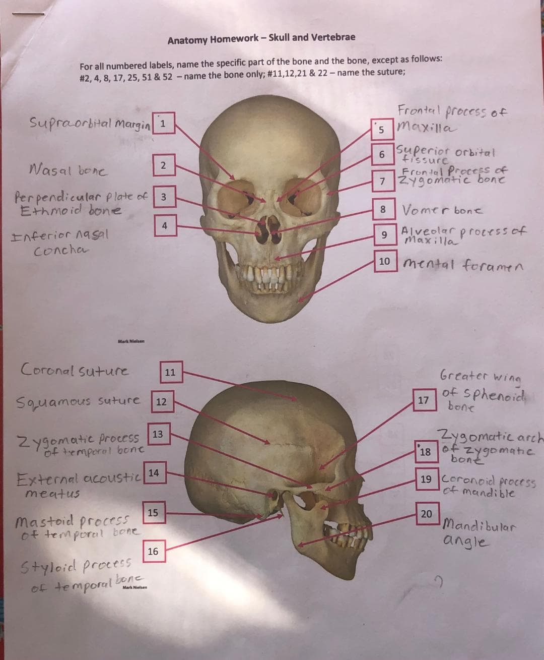 Anatomy Homework- Skull and Vertebrae
For all numbered labels, name the specific part of the bone and the bone, except as follows:
# 2, 4, 8, 17, 25, 51 & 52 - name the bone only; #11,12,21 & 22 - name the suture;
Supraorbital Margin
Fronterl process of
5 maxilla
1
6 Superior orbital
fissure
Wasal bone
Frontal Process of
7 Zygomátic bone
Per pendicular p late of
Ethmoid bone
8
Vomer bone
Alveolar processof
Inferior nasal
Concha
9.
Maxilla
10 mental foramen
Mark Nielsen
Coronal Suture
Greater wing
11
of Sphenoid
bone
17
Squamous suture
12
Zygomatic process 13
of temporal bone
Zygomatic arch
Zygomatic
of
bont
18
External acoustic 14
meatus
19 Coronoidl process
of mandible
15
mastoid process
of temporal bone
20
Mandibular
angle
16
Styloid process
of temporal bene
Mark Nielsen
