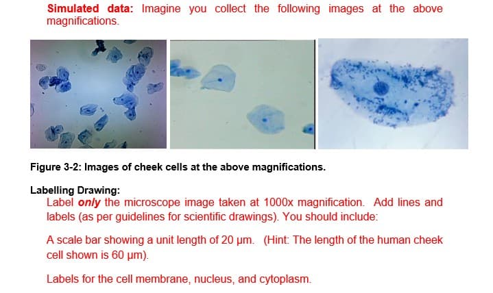 Simulated data: Imagine you collect the following images at the above
magnifications.
Figure 3-2: Images of cheek cells at the above magnifications.
Labelling Drawing:
Label only the microscope image taken at 1000x magnification. Add lines and
labels (as per guidelines for scientific drawings). You should include:
A scale bar showing a unit length of 20 µm. (Hint: The length of the human cheek
cell shown is 60 um).
Labels for the cell membrane, nucleus, and cytoplasm.

