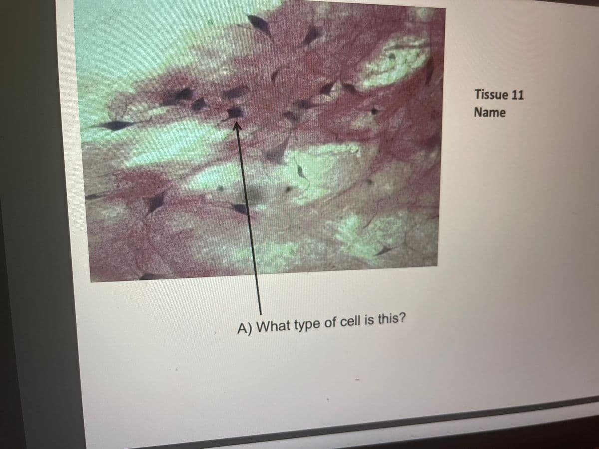 Tissue 11
Name
A) What type of cell is this?
